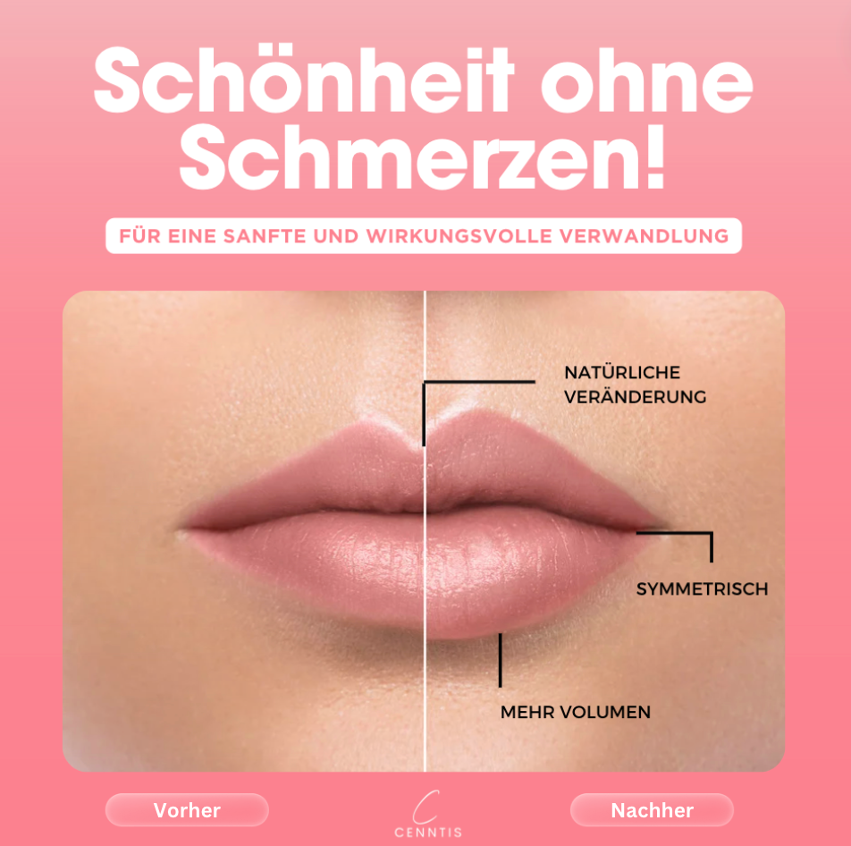 Liplift Set + Gratis Lipcooler